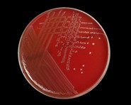 enterococcus faecalis on blood agar